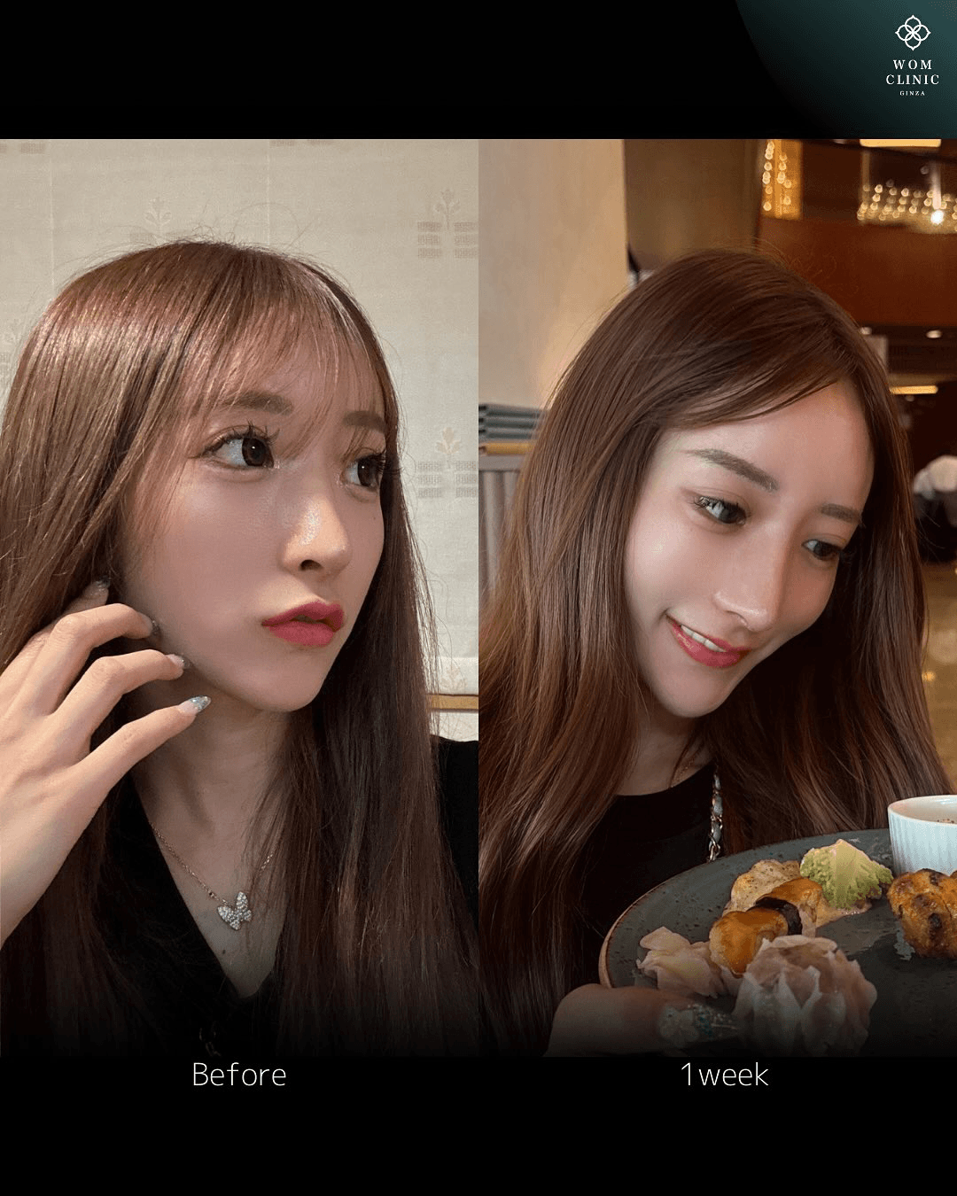 Personal before-and-after photos provided by the patient