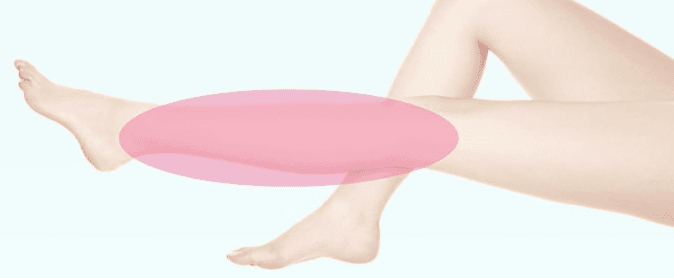 Calf liposuction areas