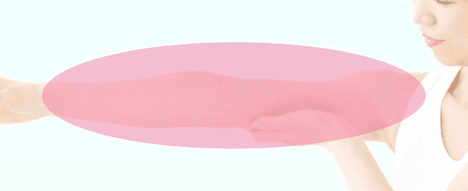 Upper arm, shoulder and axillary liposuction areas