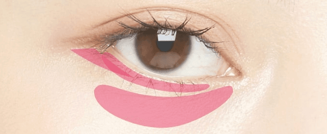 Almond eye surgery treatment area