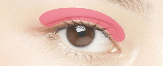 Double eyelid surgery treatment area