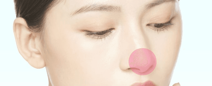 Nasal tip plasty treatment area