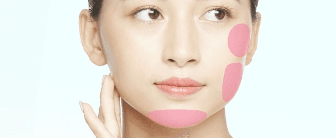 Treatment areas for three-point facial contouring