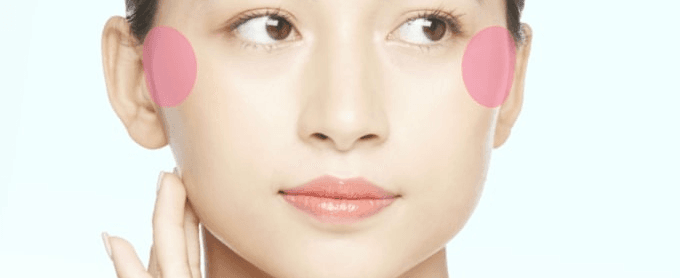 Treatment area for zygoma reduction