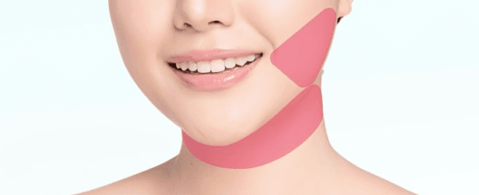 Cheek and chin liposuction treatment areas