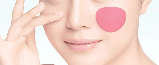 Malar fat removal treatment area